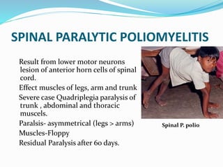 SPINAL PARALYTIC POLIOMYELITIS
Result from lower motor neurons
lesion of anterior horn cells of spinal
cord.
Effect muscles of legs, arm and trunk
Severe case Quadriplegia paralysis of
trunk , abdominal and thoracic
muscels.
Paralsis- asymmetrical (legs > arms)
Muscles-Floppy
Residual Paralysis after 60 days.
Spinal P. polio
 