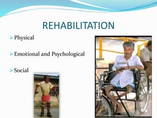 REHABILITATION
Physical
Emotional and Psychological
Social
 