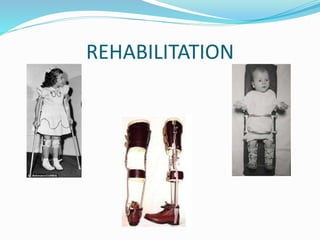 REHABILITATION
 