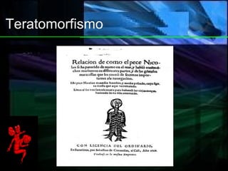 Teratomorfismo 