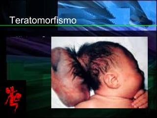 Teratomorfismo 