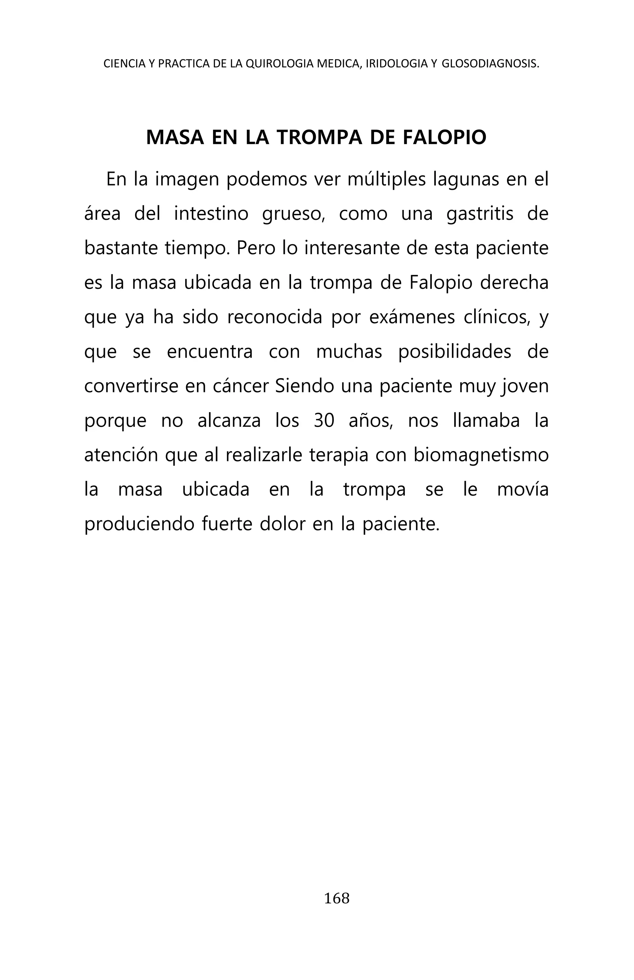 CIENCIA Y PRACTICA DE LA QUIROLOGIA MEDICA, IRIDOLOGIA Y GLOSODIAGNOSIS.
168
MASA EN LA TROMPA DE FALOPIO
En la imagen podemos ver múltiples lagunas en el
área del intestino grueso, como una gastritis de
bastante tiempo. Pero lo interesante de esta paciente
es la masa ubicada en la trompa de Falopio derecha
que ya ha sido reconocida por exámenes clínicos, y
que se encuentra con muchas posibilidades de
convertirse en cáncer Siendo una paciente muy joven
porque no alcanza los 30 años, nos llamaba la
atención que al realizarle terapia con biomagnetismo
la masa ubicada en la trompa se le movía
produciendo fuerte dolor en la paciente.
 