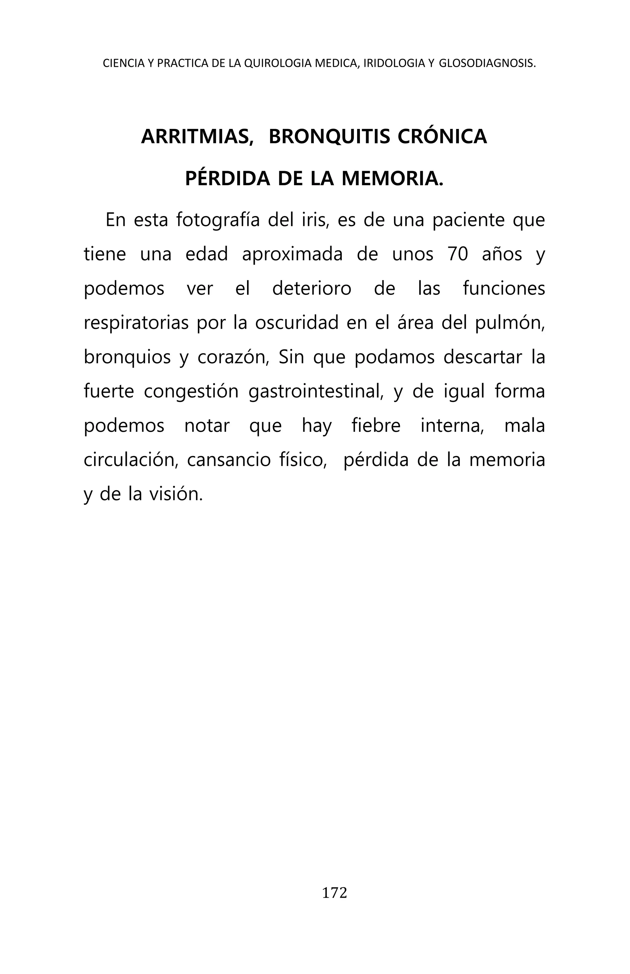 CIENCIA Y PRACTICA DE LA QUIROLOGIA MEDICA, IRIDOLOGIA Y GLOSODIAGNOSIS.
172
ARRITMIAS, BRONQUITIS CRÓNICA
PÉRDIDA DE LA MEMORIA.
En esta fotografía del iris, es de una paciente que
tiene una edad aproximada de unos 70 años y
podemos ver el deterioro de las funciones
respiratorias por la oscuridad en el área del pulmón,
bronquios y corazón, Sin que podamos descartar la
fuerte congestión gastrointestinal, y de igual forma
podemos notar que hay fiebre interna, mala
circulación, cansancio físico, pérdida de la memoria
y de la visión.
 