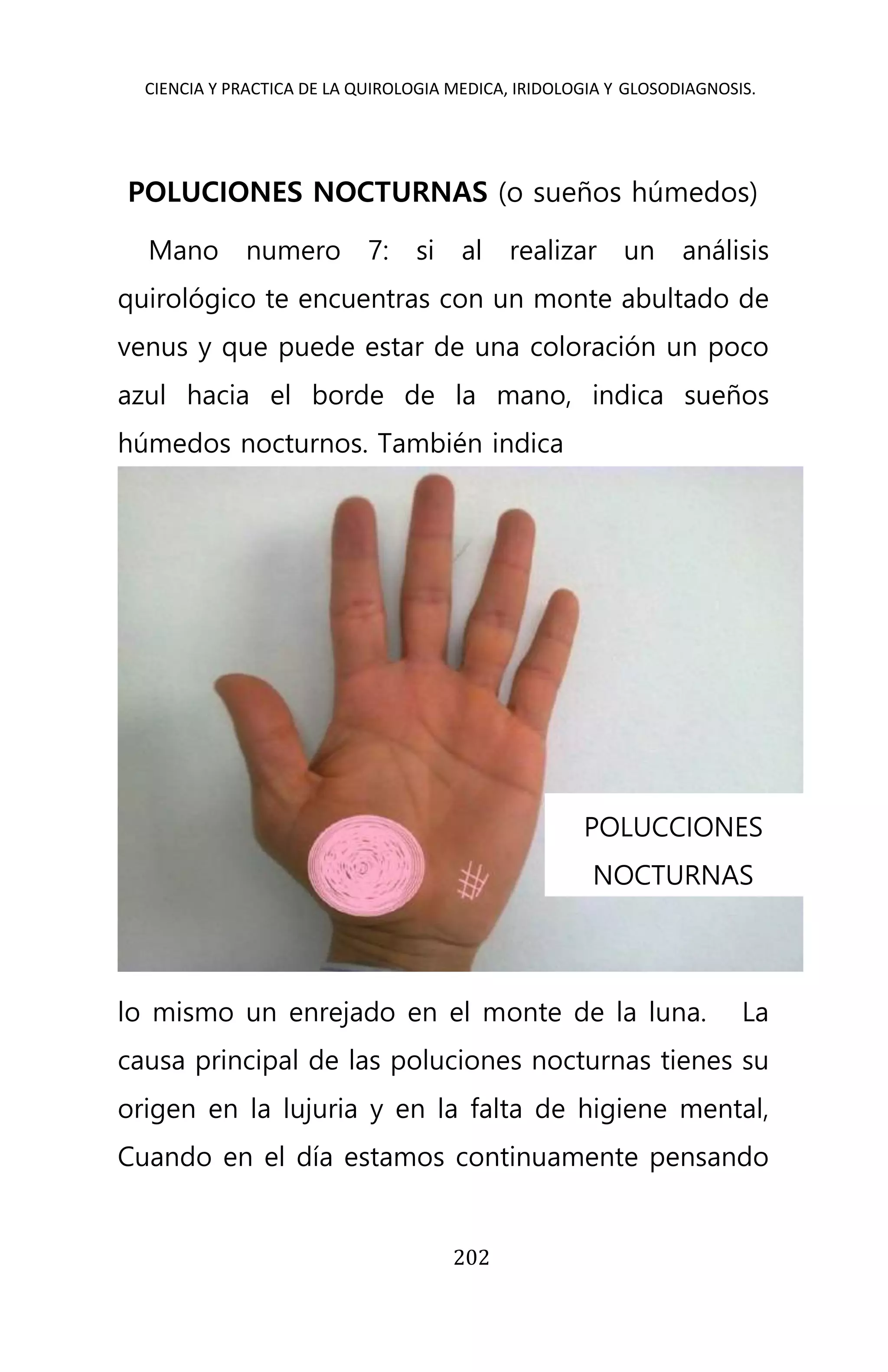 CIENCIA Y PRACTICA DE LA QUIROLOGIA MEDICA, IRIDOLOGIA Y GLOSODIAGNOSIS.
202
POLUCIONES NOCTURNAS (o sueños húmedos)
Mano numero 7: si al realizar un análisis
quirológico te encuentras con un monte abultado de
venus y que puede estar de una coloración un poco
azul hacia el borde de la mano, indica sueños
húmedos nocturnos. También indica
lo mismo un enrejado en el monte de la luna. La
causa principal de las poluciones nocturnas tienes su
origen en la lujuria y en la falta de higiene mental,
Cuando en el día estamos continuamente pensando
POLUCCIONES
NOCTURNAS
 