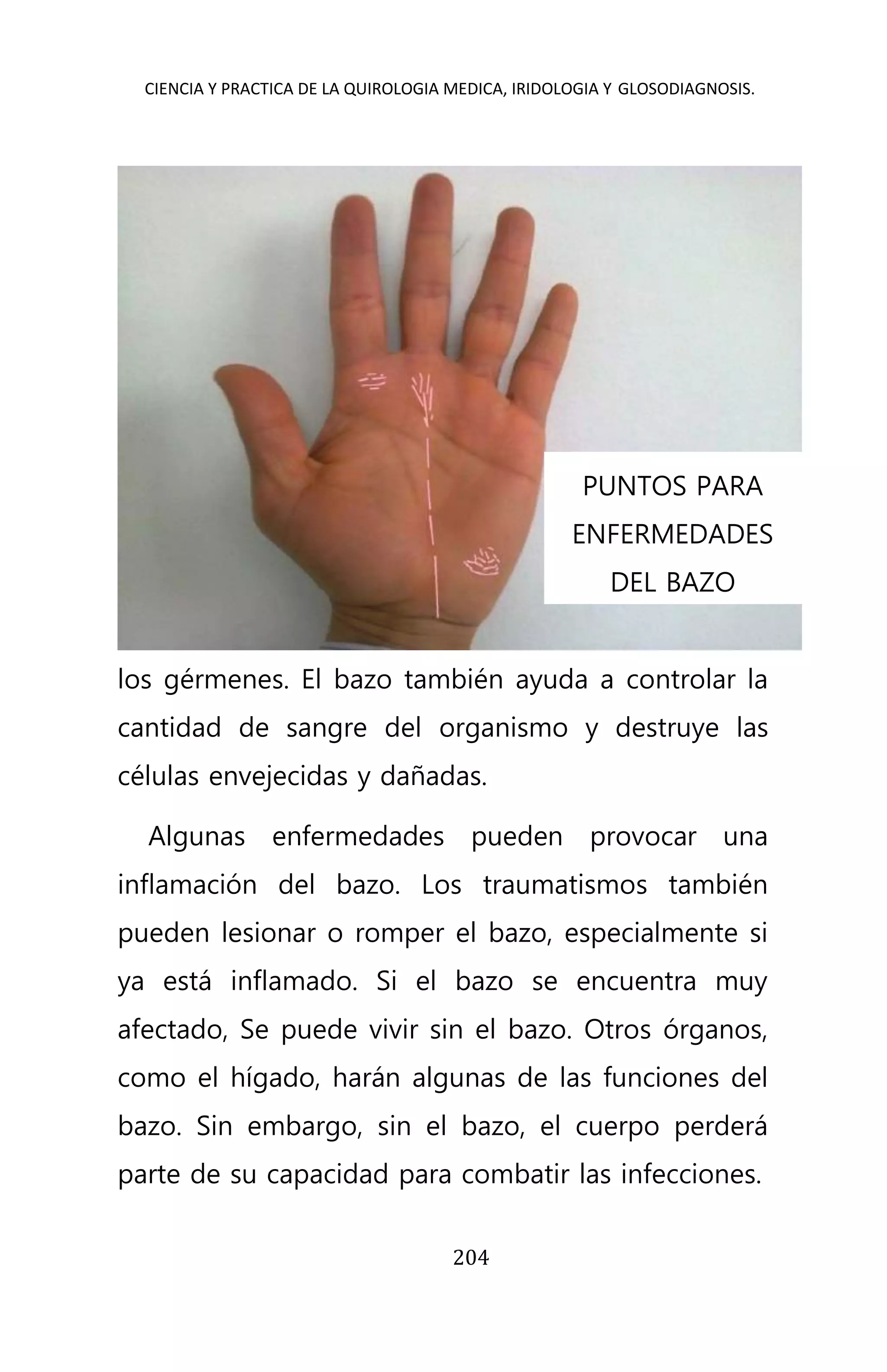 CIENCIA Y PRACTICA DE LA QUIROLOGIA MEDICA, IRIDOLOGIA Y GLOSODIAGNOSIS.
204
los gérmenes. El bazo también ayuda a controlar la
cantidad de sangre del organismo y destruye las
células envejecidas y dañadas.
Algunas enfermedades pueden provocar una
inflamación del bazo. Los traumatismos también
pueden lesionar o romper el bazo, especialmente si
ya está inflamado. Si el bazo se encuentra muy
afectado, Se puede vivir sin el bazo. Otros órganos,
como el hígado, harán algunas de las funciones del
bazo. Sin embargo, sin el bazo, el cuerpo perderá
parte de su capacidad para combatir las infecciones.
PUNTOS PARA
ENFERMEDADES
DEL BAZO
 