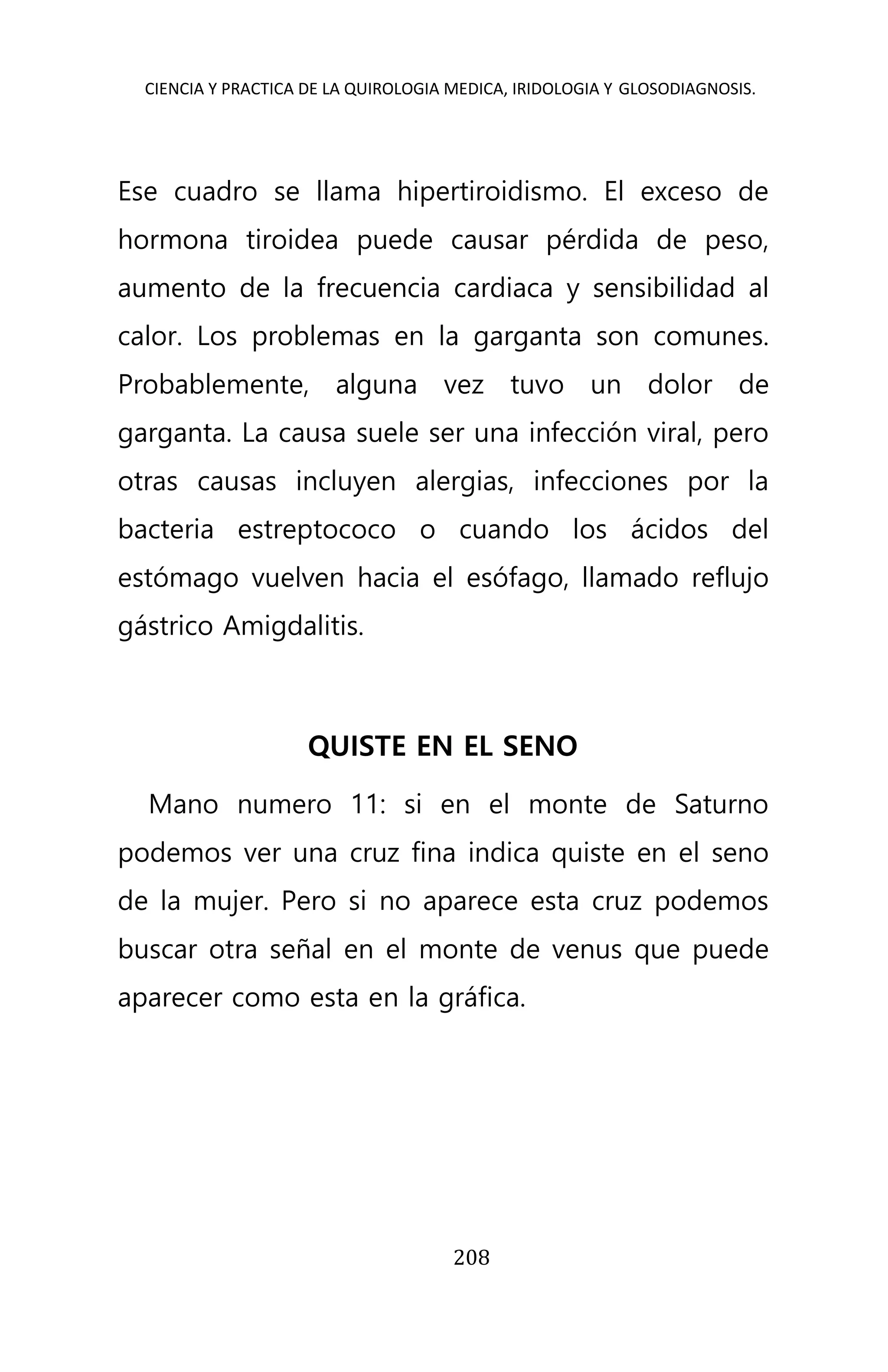 CIENCIA Y PRACTICA DE LA QUIROLOGIA MEDICA, IRIDOLOGIA Y GLOSODIAGNOSIS.
208
Ese cuadro se llama hipertiroidismo. El exceso de
hormona tiroidea puede causar pérdida de peso,
aumento de la frecuencia cardiaca y sensibilidad al
calor. Los problemas en la garganta son comunes.
Probablemente, alguna vez tuvo un dolor de
garganta. La causa suele ser una infección viral, pero
otras causas incluyen alergias, infecciones por la
bacteria estreptococo o cuando los ácidos del
estómago vuelven hacia el esófago, llamado reflujo
gástrico Amigdalitis.
QUISTE EN EL SENO
Mano numero 11: si en el monte de Saturno
podemos ver una cruz fina indica quiste en el seno
de la mujer. Pero si no aparece esta cruz podemos
buscar otra señal en el monte de venus que puede
aparecer como esta en la gráfica.
 