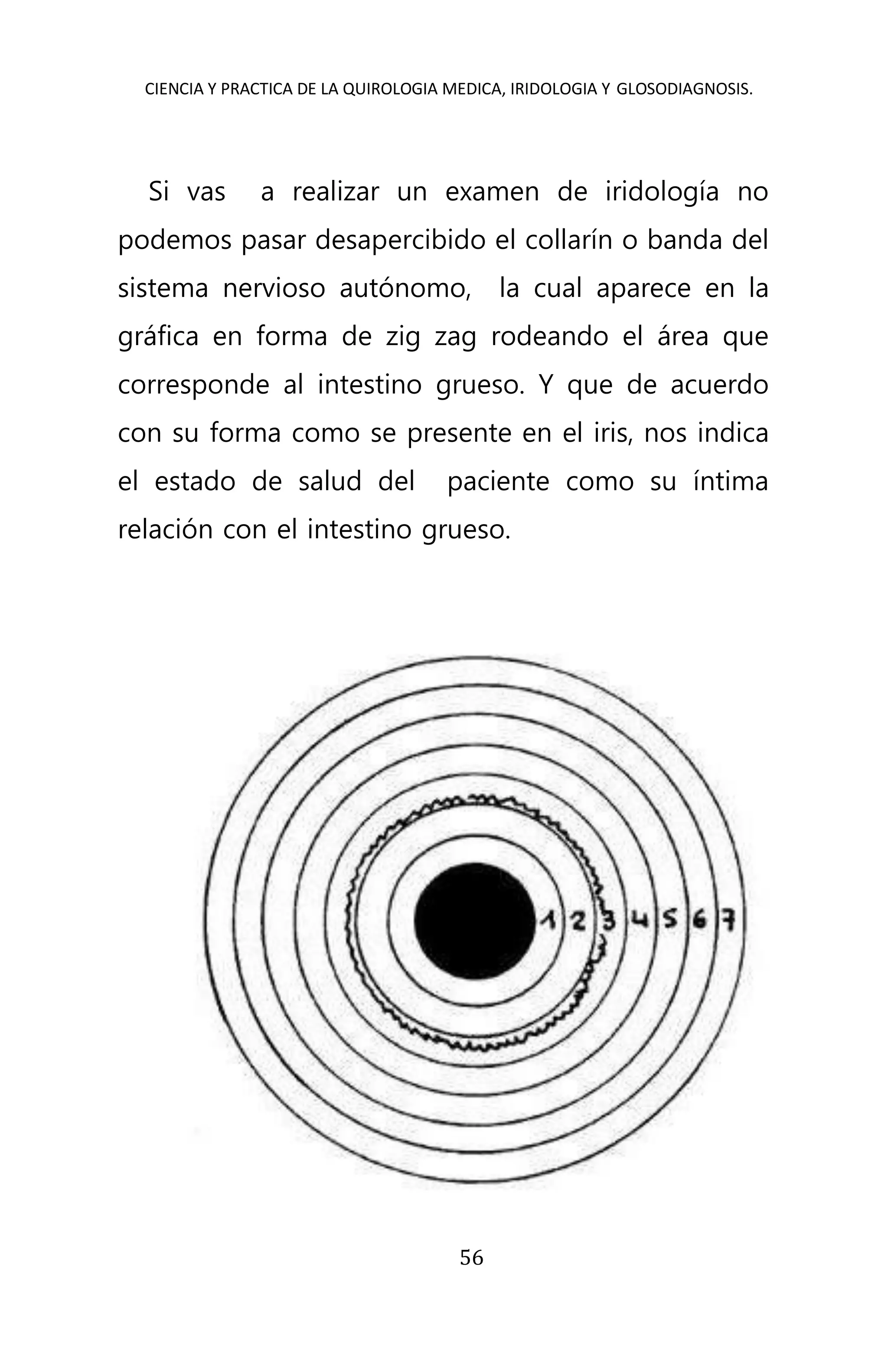 CIENCIA Y PRACTICA DE LA QUIROLOGIA MEDICA, IRIDOLOGIA Y GLOSODIAGNOSIS.
56
Si vas a realizar un examen de iridología no
podemos pasar desapercibido el collarín o banda del
sistema nervioso autónomo, la cual aparece en la
gráfica en forma de zig zag rodeando el área que
corresponde al intestino grueso. Y que de acuerdo
con su forma como se presente en el iris, nos indica
el estado de salud del paciente como su íntima
relación con el intestino grueso.
 