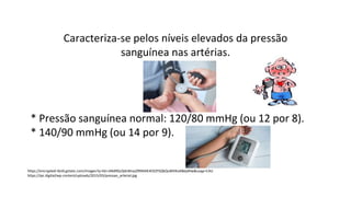 Caracteriza-se pelos níveis elevados da pressão
sanguínea nas artérias.
* Pressão sanguínea normal: 120/80 mmHg (ou 12 por 8).
* 140/90 mmHg (ou 14 por 9).
https://encrypted-tbn0.gstatic.com/images?q=tbn:ANd9GcQdnBnazZ9ltRAlE4CKZYSQkQuMVKoABejdHw&usqp=CAU
https://ipc.digital/wp-content/uploads/2015/03/pressao_arterial.jpg
 