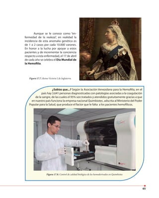 65
Aunque se le conoce como “en-
fermedad de la realeza”, en realidad la
incidencia de esta anomalía genética es
de 1 a 2 casos por cada 10.000 varones.
En honor a la lucha por apoyar a estos
pacientes y de incrementar la conciencia
respecto a esta enfermedad, el 17 de abril
de cada año se celebra el Día Mundial de
la Hemofilia.
¿Sabías que...? Según la Asociación Venezolana para la Hemofilia, en el
país hay 3.641 personas diagnosticadas con patologías asociadas a la coagulación
de la sangre, de las cuales el 95% son tratados y atendidos gratuitamente gracias a que
en nuestro país funciona la empresa nacional Quimbiotec, adscrita al Ministerio del Poder
Popular para la Salud, que produce el factor que le falta a los pacientes hemofílicos.
Figura 17.8. Control de calidad biológica de los hemoderivados en Quimbiotec
Figura 17.7. Reina Victoria I de Inglaterra.
 