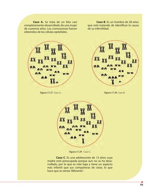 79
Caso A. Se trata de un feto casi
completamente desarrollado de una mujer
de cuarenta años. Los cromosomas fueron
obtenidos de las células epiteliales.
Caso B. Es un hombre de 28 años
que está tratando de identificar la causa
de su infertilidad.
Figura 17.27. Caso A. Figura 17.28. Caso B.
Caso C. Es una adolescente de 13 años cuya
madre está preocupada porque aun no se ha desa-
rrollado, por lo que es más baja y tiene un aspecto
más infantil que sus compañeras de clase, lo que
hace que se sienta“diferente”.
Figura 17.29. Caso C.
 