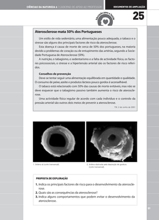 CIÊNCIAS DA NATUREZA 6 | CADERNO DE APOIO AO PROFESSOR                            DOCUMENTOS DE AMPLIAÇÃO

                                                                         ar
                                                                     ão p a a S
                                                                   aç
                                                                                                     25




                                                                              aú
                                                               c
                                                            Edu




                                                                                de
      Aterosclerose mata 50% dos Portugueses
          Um estilo de vida sedentário, uma alimentação pouco adequada, o tabaco e o
      stresse são alguns dos principais factores de risco da aterosclerose.
          Esta doença é causa de morte de cerca de 50% dos portugueses, na maioria
      devido a problemas de coração ou de entupimento das artérias, segundo a Socie-
      dade Portuguesa de Aterosclerose (SPA).
          A nutrição, o tabagismo, o sedentarismo e a falta de actividade física, os facto-
      res psicossociais, o stresse e a hipertensão arterial são os factores de risco referi-
      dos.

         Conselhos de prevenção
         Deve-se tentar seguir uma alimentação equilibrada em quantidade e qualidade.
      O consumo de peixe, azeite e produtos lácteos pouco gordos é aconselhável.
         O tabaco está relacionado com 50% das causas de morte evitáveis, mas não se
      deve esquecer que o tabagismo passivo também aumenta o risco de ateroscle-
      rose.
         Uma actividade física regular de acordo com cada indivíduo e o controlo da
      pressão arterial são outros dois meios de prevenir a aterosclerose.
                                                                                  TSF, 2 de Junho de 2001




    1. Artéria sã (corte transversal).            2. Artéria obstruída pela deposição de gordura
                                                     (corte transversal).




       PROPOSTA DE EXPLORAÇÃO

       1. Indica os principais factores de risco para o desenvolvimento da ateroscle-
          rose.
       2. Quais são as consequências da aterosclerose?
       3. Indica alguns comportamentos que podem evitar o desenvolvimento da
          aterosclerose.

                                                                                                            51
 