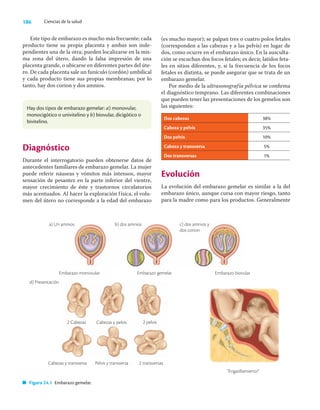 186 Ciencias de la salud
Este tipo de embarazo es mucho más frecuente; cada
producto tiene su propia placenta y ambas son inde-
pendientes una de la otra; pueden localizarse en la mis-
ma zona del útero, dando la falsa impresión de una
placenta grande, o ubicarse en diferentes partes del úte-
ro. De cada placenta sale un funículo (cordón) umbilical
y cada producto tiene sus propias membranas; por lo
tanto, hay dos corion y dos amnios.
(es mucho mayor); se palpan tres o cuatro polos fetales
(corresponden a las cabezas y a las pelvis) en lugar de
dos, como ocurre en el embarazo único. En la ausculta-
ción se escuchan dos focos fetales; es decir, latidos feta-
les en sitios diferentes, y, si la frecuencia de los focos
fetales es distinta, se puede asegurar que se trata de un
embarazo gemelar.
Por medio de la ultrasonografía pélvica se conﬁrma
el diagnóstico temprano. Las diferentes combinaciones
que pueden tener las presentaciones de los gemelos son
las siguientes:
Dos cabezas 38%
Cabeza y pelvis 35%
Dos pelvis 10%
Cabeza y transversa 5%
Dos transversas 1%
Evolución
La evolución del embarazo gemelar es similar a la del
embarazo único, aunque cursa con mayor riesgo, tanto
para la madre como para los productos. Generalmente
Hay dos tipos de embarazo gemelar: a) monovular,
monocigótico o univitelino y b) biovular, dicigótico o
bivitelino.
Diagnóstico
Durante el interrogatorio pueden obtenerse datos de
antecedentes familiares de embarazo gemelar. La mujer
puede referir náuseas y vómitos más intensos, mayor
sensación de pesantez en la parte inferior del vientre,
mayor crecimiento de éste y trastornos circulatorios
más acentuados. Al hacer la exploración física, el volu-
men del útero no corresponde a la edad del embarazo
a) Un amnios b) dos amnios c) dos amnios y
dos corion
Embarazo monovular Embarazo gemelar Embarazo biovular
d) Presentación
2 Cabezas Cabezas y pelvis 2 pelvis
Cabezas y transversa Pelvis y transversa 2 transversas
“Engatillamiento”
Figura 24.1 Embarazo gemelar.
 