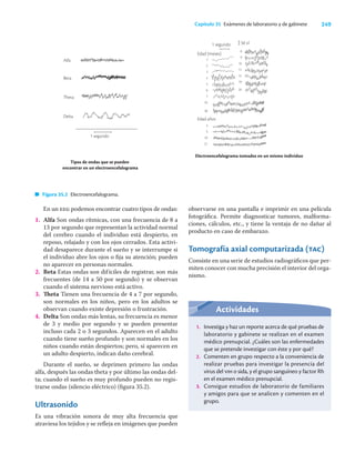 249
Capítulo 35 Exámenes de laboratorio y de gabinete
En un eeg podemos encontrar cuatro tipos de ondas:
1. Alfa Son ondas rítmicas, con una frecuencia de 8 a
13 por segundo que representan la actividad normal
del cerebro cuando el individuo está despierto, en
reposo, relajado y con los ojos cerrados. Esta activi-
dad desaparece durante el sueño y se interrumpe si
el individuo abre los ojos o ﬁja su atención; pueden
no aparecer en personas normales.
2. Beta Estas ondas son difíciles de registrar, son más
frecuentes (de 14 a 50 por segundo) y se observan
cuando el sistema nervioso está activo.
3. Theta Tienen una frecuencia de 4 a 7 por segundo,
son normales en los niños, pero en los adultos se
observan cuando existe depresión o frustración.
4. Delta Son ondas más lentas, su frecuencia es menor
de 3 y medio por segundo y se pueden presentar
incluso cada 2 o 3 segundos. Aparecen en el adulto
cuando tiene sueño profundo y son normales en los
niños cuando están despiertos; pero, si aparecen en
un adulto despierto, indican daño cerebral.
Durante el sueño, se deprimen primero las ondas
alfa, después las ondas theta y por último las ondas del-
ta; cuando el sueño es muy profundo pueden no regis-
trarse ondas (silencio eléctrico) (ﬁgura 35.2).
Ultrasonido
Es una vibración sonora de muy alta frecuencia que
atraviesa los tejidos y se reﬂeja en imágenes que pueden
observarse en una pantalla e imprimir en una película
fotográﬁca. Permite diagnosticar tumores, malforma-
ciones, cálculos, etc., y tiene la ventaja de no dañar al
producto en caso de embarazo.
Tomografía axial computarizada (tac)
Consiste en una serie de estudios radiográﬁcos que per-
miten conocer con mucha precisión el interior del orga-
nismo.
Figura 35.2 Electroencefalograma.
Actividades
1. Investiga y haz un reporte acerca de qué pruebas de
laboratorio y gabinete se realizan en el examen
médico prenupcial. ¿Cuáles son las enfermedades
que se pretende investigar con éste y por qué?
2. Comenten en grupo respecto a la conveniencia de
realizar pruebas para investigar la presencia del
virus del vih o sida, y el grupo sanguíneo y factor Rh
en el examen médico prenupcial.
3. Consigue estudios de laboratorio de familiares
y amigos para que se analicen y comenten en el
grupo.
Alfa
Beta
Theta
Delta
1 segundo
Tipos de ondas que se pueden
encontrar en un electroencefalograma
Electroencefalograma tomados en un mismo individuo
1 segundo
Edad (meses)
Edad años
1
2
3
4
5
6
7
33
36
8
9
10
11
12
19
26
4
5
10
21
50 vl
 