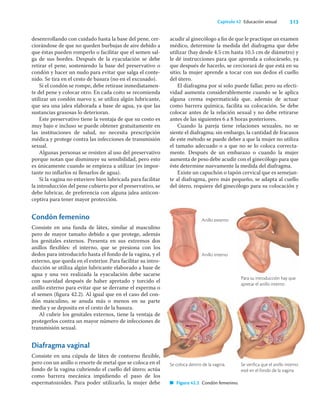 313
Capítulo 42 Educación sexual
desenrrollando con cuidado hasta la base del pene, cer-
ciorándose de que no queden burbujas de aire debido a
que éstas pueden romperlo o facilitar que el semen sal-
ga de sus bordes. Después de la eyaculación se debe
retirar el pene, sosteniendo la base del preservativo o
condón y hacer un nudo para evitar que salga el conte-
nido. Se tira en el cesto de basura (no en el excusado).
Si el condón se rompe, debe retirase inmediatamen-
te del pene y colocar otro. En cada coito se recomienda
utilizar un condón nuevo y, se utiliza algún lubricante,
que sea una jalea elaborada a base de agua, ya que las
sustancias grasosas lo deterioran.
Este preservativo tiene la ventaja de que su costo es
muy bajo e incluso se puede obtener gratuitamente en
las instituciones de salud, no necesita prescripción
médica y protege contra las infecciones de transmisión
sexual.
Algunas personas se resisten al uso del preservativo
porque notan que disminuye su sensibilidad, pero esto
es únicamente cuando se empieza a utilizar (es impor-
tante no inﬂarlos ni llenarlos de agua).
Si la vagina no estuviere bien lubricada para facilitar
la introducción del pene cubierto por el preservativo, se
debe lubricar, de preferencia con alguna jalea anticon-
ceptiva para tener mayor protección.
Condón femenino
Consiste en una funda de látex, similar al masculino
pero de mayor tamaño debido a que protege