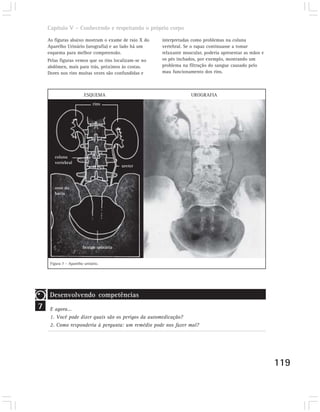 Capítulo V – Conhecendo e respeitando o próprio corpo

    As figuras abaixo mostram o exame de raio X do    interpretadas como problemas na coluna
    Aparelho Urinário (urografia) e ao lado há um     vertebral. Se o rapaz continuasse a tomar
    esquema para melhor compreensão.                  relaxante muscular, poderia apresentar as mãos e
    Pelas figuras vemos que os rins localizam-se no   os pés inchados, por exemplo, mostrando um
    abdômen, mais para trás, próximos às costas.      problema na filtração do sangue causado pelo
    Dores nos rins muitas vezes são confundidas e     mau funcionamento dos rins.



                         ESQUEMA                                   UROGRAFIA
                              rins




       coluna
       vertebral
                                          ureter




       osso da
       bacia




                        bexiga urinária


     Figura 7 – Aparelho urinário.




     Desenvolvendo competências
7    E agora...
     1. Você pode dizer quais são os perigos da automedicação?
     2. Como responderia à pergunta: um remédio pode nos fazer mal?




                                                                                                         119
 