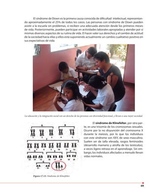 69
El síndrome de Down es la primera causa conocida de dificultad intelectual, representan-
do aproximadamente el 25% de todos los casos. Las personas con síndrome de Down pueden
asistir a la escuela sin problemas, si reciben una adecuada atención desde los primeros meses
de vida. Posteriormente, pueden participar en actividades laborales apropiadas y atender por sí
mismas diversos aspectos de su rutina de vida. El hacer valer sus derechos y el cambio de actitud
de la sociedad hacia ellas y ellos está suponiendo actualmente un cambio cualitativo positivo en
sus expectativas de vida.
El síndrome de Klinefelter, por otra par-
te, es una trisomía de los cromosomas sexuales.
Ocurre por la no disyunción del cromosoma X
durante la meiosis, por lo que los individuos
con este síndrome son XXY, de sexo masculino.
Suelen ser de talla elevada, rasgos feminoides
(desarrollo mamario y atrofia de los testículos),
a veces ligero retraso en el aprendizaje. Sin em-
bargo, los individuos afectados a menudo llevan
vidas normales.
La educación y la integración social son un derecho de las personas con diversidad funcional, y llevan a una mejor sociedad.
Figura 17.13. Síndrome de Klinefelter.
 