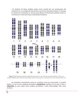 72
Figura 17.18. Translocación del brazo largo del cromosoma 21 en uno de los dos cromosomas del par 14. Este es un
cariotipo idealizado (que muestra la situación para hombre o mujer), por eso se muestran a la vez los cromosomas XX y XY.
• El síndrome de Down también puede ocurrir cuando hay una translocación del
cromosoma 21 (o un fragmento del mismo) a uno de los cromosomas del par 14. Aunque
el número de cromosomas es normal, para efectos de información genética existe un
“cromosoma 21 extra”, por lo que se desarrolla el síndrome.
Las anomalías cromosómicas, tanto las numéricas como las estructurales, se pueden
dividir a su vez en dos categorías principales: constitutivas, aquellas con las que se nace, y
adquiridas, las que surgen como cambios secundarios a otras enfermedades, tales como
el cáncer.
 