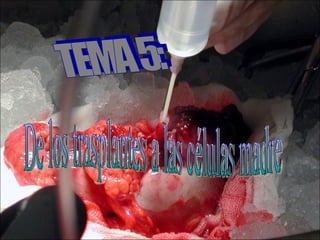 TEMA 5: De los trasplantes a las células madre 