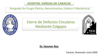 Dr. Hanmer Roa
HOSPITAL VARGAS DE CARACAS
Postgrado De Cirugía Plástica, Reconstructiva, Estética Y MáxiloFacial
Cierre de Defectos Circulares
Mediante Colgajos
Caracas, Venezuela: Junio 2020
 