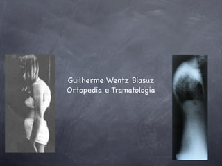 Guilherme Wentz Biasuz
Ortopedia e Tramatologia
 