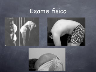 Exame ﬁsico
 
