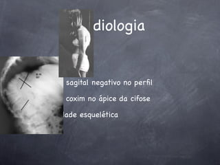 Radiologia


balanço sagital negativo no perﬁl

Rx com coxim no ápice da cifose

maturidade esquelética
 