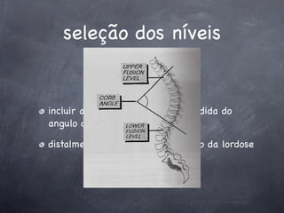 seleção dos níveis


incluir a vértebra proximal da medida do
angulo de Cobb

distalmente incluir o primeiro disco da lordose
 