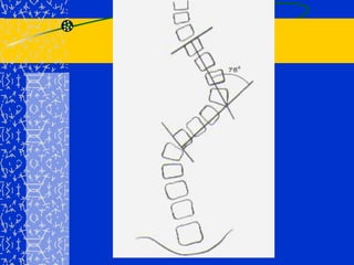 Dirección del vértice de la curva.