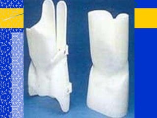 ESCOLIOSIS IDIOPATICAINFANTIL:(0-3 años) 