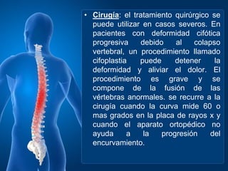 Cifosis E Hipercifosis PPT Cifosis E Hipercifosis PPT