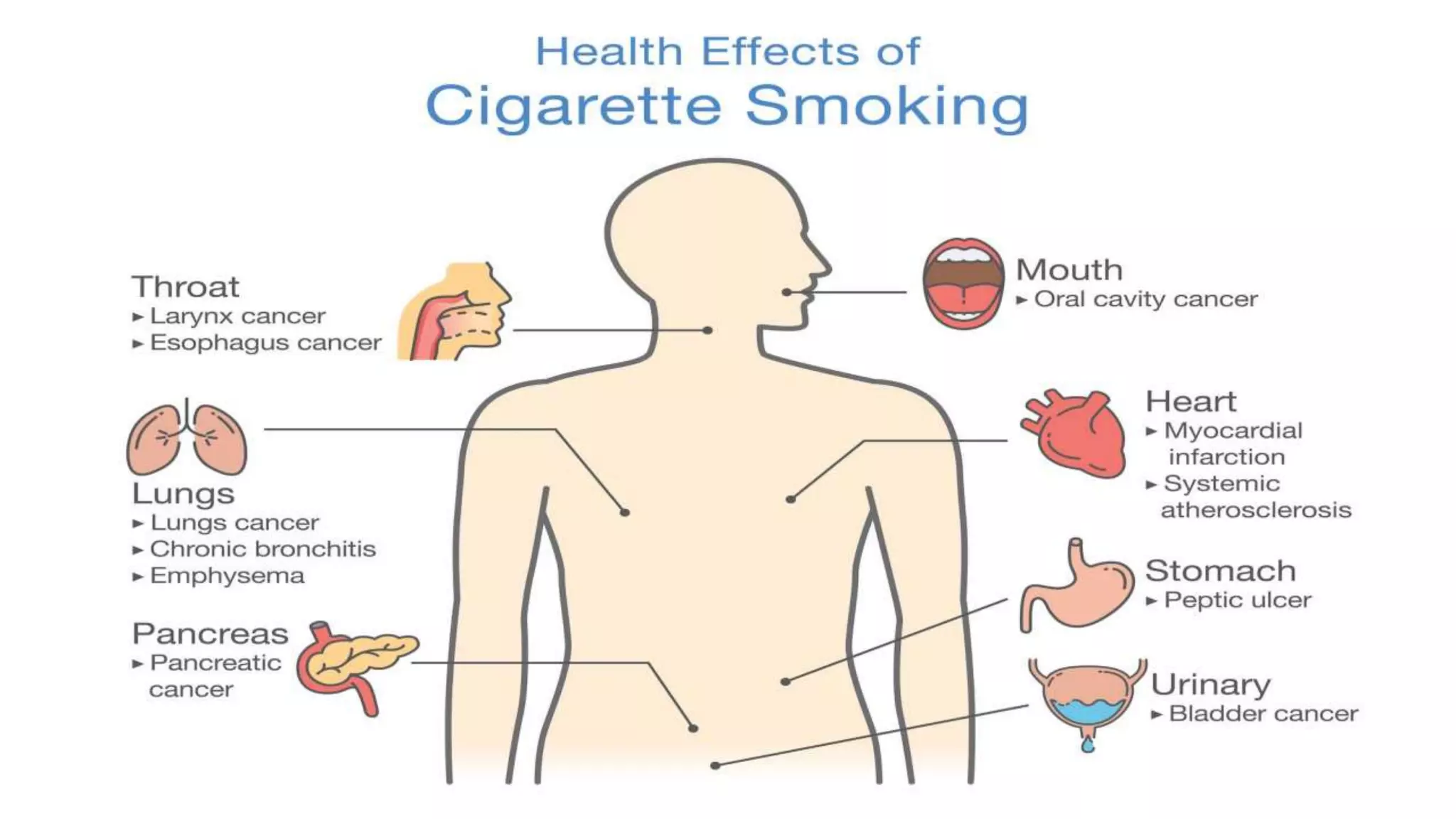 Cigarette smoking and its ill effects | PPTX