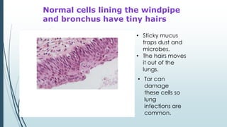 Normal cells lining the windpipe
and bronchus have tiny hairs
• Tar can
damage
these cells so
lung
infections are
common.
• Sticky mucus
traps dust and
microbes.
• The hairs moves
it out of the
lungs.
 