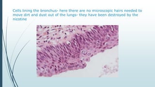 Cells lining the bronchus- here there are no microscopic hairs needed to
move dirt and dust out of the lungs- they have been destroyed by the
nicotine
 