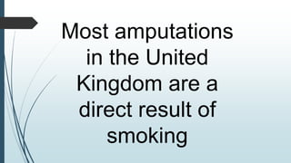 Most amputations
in the United
Kingdom are a
direct result of
smoking
 