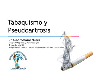 Tabaquismo y
Pseudoartrosis
Dr. Omar Salazar Núñez
Cirugía Ortopédica y Traumatología
Ortopedia Infantil
Alargamiento y Corrección de Deformidades de las Extremidades
 