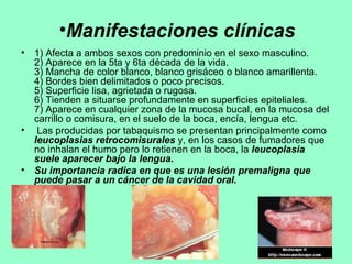 1) Afecta a ambos sexos con predominio en el sexo masculino. 2) Aparece en la 5ta y 6ta década de la vida. 3) Mancha de color blanco, blanco grisáceo o blanco amarillenta. 4) Bordes bien delimitados o poco precisos. 5) Superficie lisa, agrietada o rugosa. 6) Tienden a situarse profundamente en superficies epiteliales. 7) Aparece en cualquier zona de la mucosa bucal, en la mucosa del carrillo o comisura, en el suelo de la boca, encía, lengua etc. Las producidas por tabaquismo se presentan principalmente como  leucoplasias retrocomisurales  y, en los casos de fumadores que no inhalan el humo pero lo retienen en la boca, la  leucoplasia suele aparecer bajo la lengua.   Su importancia radica en que es una lesión premaligna que puede pasar a un cáncer de la cavidad oral. Manifestaciones clínicas  