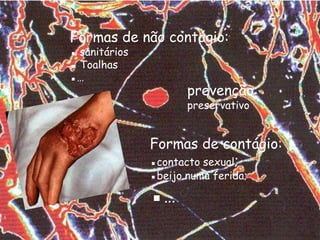 Formas de não contágio:▪ sanitários▪ Toalhas▪…prevenção:preservativoFormas de contágio:▪contacto sexual;▪beijo numa ferida;▪…