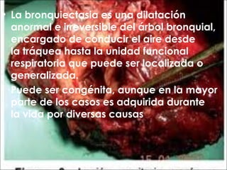 • La bronquiectasia es una dilatación
  anormal e irreversible del árbol bronquial,
  encargado de conducir el aire desde
  la tráquea hasta la unidad funcional
  respiratoria que puede ser localizada o
  generalizada.
  Puede ser congénita, aunque en la mayor
  parte de los casos es adquirida durante
  la vida por diversas causas
 