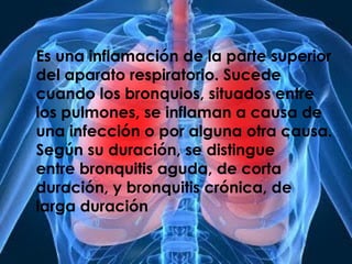 Es una inflamación de la parte superior
del aparato respiratorio. Sucede
cuando los bronquios, situados entre
los pulmones, se inflaman a causa de
una infección o por alguna otra causa.
Según su duración, se distingue
entre bronquitis aguda, de corta
duración, y bronquitis crónica, de
larga duración
 