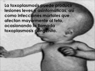 La toxoplasmosis puede producir
lesiones leves y asintomáticas, así
como infecciones mortales que
afectan mayormente al feto,
ocasionando la llamada
toxoplasmosis congénita.
 