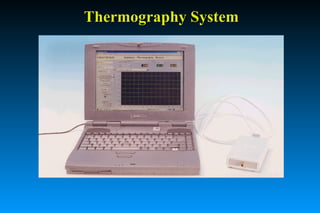 Thermography SystemThermography System
 
