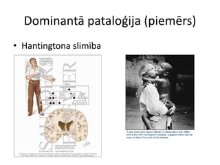 Dominantā pataloģija (piemērs)
• Hantingtona slimība
 
