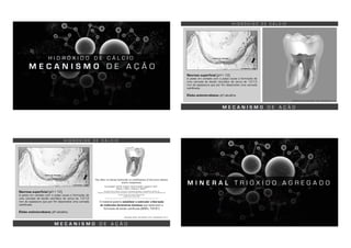 M E C A N I S M O D E A Ç Ã O
H I D R Ó X I D O D E C Á L C I O
M E C A N I S M O D E A Ç Ã O
Necrose superficial (pH > 12)
A pasta em contato com a polpa causa a formação de
uma camada de tecido necrótico de cerca de 1,0-1,5
mm de espessura que por fim desenvolve uma camada
calcificada.
Efeito antimicrobiano: pH alcalino.
GRAHAM, 2006; VAN NOORT, 2007; ANUSAVICE, 2013
H I D R Ó X I D O D E C Á L C I O
ACORRINTE, 2008
PONTE DE DENTINA
M E C A N I S M O D E A Ç Ã O
Necrose superficial (pH > 12)
A pasta em contato com a polpa causa a formação de
uma camada de tecido necrótico de cerca de 1,0-1,5
mm de espessura que por fim desenvolve uma camada
calcificada.
Efeito antimicrobiano: pH alcalino.
H I D R Ó X I D O D E C Á L C I O
O material poderia solubilizar e estimular a liberação
de moléculas dentinárias bioativas que estimulam a
formação de tecido calcificado (BMPs, TGF-B1)
ACORRINTE, 2008
PONTE DE DENTINA
GRAHAM, 2006; VAN NOORT, 2007; ANUSAVICE, 2013
M I N E R A L T R I Ó X I D O A G R E G A D O
 