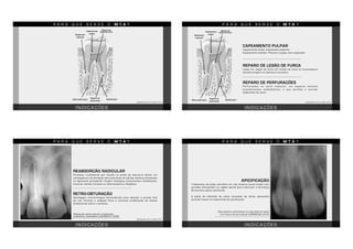 I N D I C A Ç Õ E S
P A R A Q U E S E R V E O M T A ?
Capeamento
pulpar
Reparo de
lesão de furca
ANUSAVICE, 2013; TAWII, 2015
Reaborção
radicular
Reparo de
perfuração
ApicificaçãoRetro-obturação
I N D I C A Ç Õ E S
P A R A Q U E S E R V E O M T A ?
Capeamento
pulpar
Reparo de
lesão de furca
ANUSAVICE, 2013; TAWII, 2015
Reaborção
radicular
Reparo de
perfuração
ApicificaçãoRetro-obturação
CAPEAMENTO PULPAR
Capeamento direto: Exposições pulpares
Capeamento indireto: Próximo a polpa, sem exposição
REPARO DE LESÃO DE FURCA
Lesão em região de furca em função de cárie ou traumatismo
durante preparo ou abertura coronária
REPARO DE PERFURAÇÕES
Perfurações no canal radicular, em especial durante
procedimentos endodônticos, o que permite o correto
vedamento do canal
I N D I C A Ç Õ E S
P A R A Q U E S E R V E O M T A ?
ANUSAVICE, 2013; TAWII, 2015
RETRO-OBTURAÇÃO
Abordagem microcirúrgica extraradicular para abordar a porção final
da raiz. Permite a vedação física e promove proliferação de células
diretamente sobre o cemento.
REABSORÇÃO RADICULAR
Processo multifatorial que resulta na perda de estrutura dental, em
conseqüência da atividade não-controlada de células clásticas presentes
no ligamento periodontal. Origem fisiológica (movimentos ortodônticos,
traumas, dentes inclusos ou inflamações) ou idiopática.
Reabsorção apical radicular e tratamento
endodôntico insatisfatório (JACOBOVITZ, 2009)
I N D I C A Ç Õ E S
P A R A Q U E S E R V E O M T A ?
APICIFICAÇÃO
Tratamento de polpa necrótica em raiz imatura (canal amplo com
paredes divergentes na região apical) para estimular a formação
de barreira apical calcificada.
A pasta de hidróxido de cálcio necessita de várias aplicações
durante meses no tratamento da apicificação.
Ápice aberto e perda óssea na crista distal em dente
com fratura coronorradicular (GRÜNDLING, 2010)
 