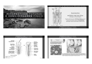 P E R S P E C T I V A S F U T U R A S
E C O N S I D E R A Ç Õ E S F I N A I S
P A R A Q U E S E R V E M O S M A T E R I A I S D E P R O T E Ç Ã O P U L P A R ?
P A R A Q U E S E R V E M O S M A T E R I A I S D E P R O T E Ç Ã O P U L P A R ?
Capeamento
pulpar
Reparo de
lesão de furca
ANUSAVICE, 2013; TAWII, 2015
Reaborção
radicular
Reparo de
perfuração
ApicificaçãoRetro-obturação
Custo-benefício
Considerar cada caso clínico
Vantagens e Desvantagens
Situações clínicas em que o Hidróxido de Cálcio não é tão
eficaz quando o MTA por causa da alta solubilidade ou
menores propriedade mecânicas: retro-obturação,
apicificação, reparo de perfuração e lesão de furca
P E R S P E C T I V A S F U T U R A S
E C O N S I D E R A Ç Õ E S F I N A I S
PIVA, 2014
P E R S P E C T I V A S F U T U R A S
E C O N S I D E R A Ç Õ E S F I N A I S
LI, 2014
P E R S P E C T I V A S F U T U R A S
E C O N S I D E R A Ç Õ E S F I N A I S
 