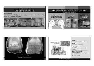 M A T E R I A I S D E P R O T E Ç Ã O P U L P A R
Ser biocompatível
M I C R O I N F I L T R A Ç Ã O
BALDISSERA, 2013MANCHAMENTO MARGINAL
Definição geral:
Influxo de fluidos orais e bactérias nos espaços entre uma superfície dental
preparada e o material restaurador
ANUSAVICE, 2013
M A T E R I A I S D E P R O T E Ç Ã O P U L P A R
PROFUNDIDADE
DAS CAVIDADES
F O R R A D O R
ANUSAVICE, 2013
FATORES PARA INDICAÇÃO
B A S E
IDADE DO
PACIENTE
CONDIÇÃO
PULPAR
M A T E R I A I S D E P R O T E Ç Ã O P U L P A R
ANUSAVICE, 2013
FATORES PARA INDICAÇÃO
IDADE DO PACIENTE
M A T E R I A I S D E P R O T E Ç Ã O P U L P A R
FATORES PARA INDICAÇÃO TORRES, 2013
RASA
Sistema adesivo + Resina Composta
MÉDIA
Sistema adesivo + Resina Composta
PROFUNDA
CIV + Amálgama
CIV + Sistema Adesivo + Resina Composta
MUITO PROFUNDA
Ca(OH)2 + CIV + Amálgama
Ca(OH)2 + CIV + Sistema Adesivo + Resina Composta
Ca(OH)2 +CIV
B A S E
F O R R A D O R
 