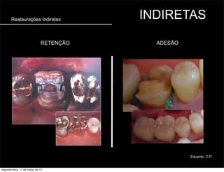Restaurações Indiretas INDIRETAS
ADESÃORETENÇÃO
Eduardo, C.P.
segunda-feira, 11 de março de 13
 