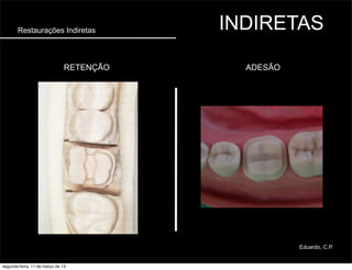 Restaurações Indiretas INDIRETAS
ADESÃORETENÇÃO
Eduardo, C.P.
segunda-feira, 11 de março de 13
 