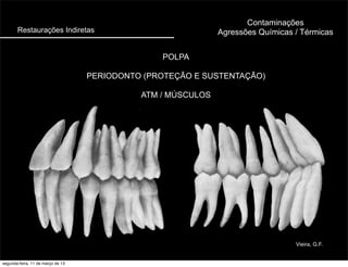 Restaurações Indiretas
POLPA
PERIODONTO (PROTEÇÃO E SUSTENTAÇÃO)
ATM / MÚSCULOS
Contaminações
Agressões Químicas / Térmicas
Vieira, G.F.
segunda-feira, 11 de março de 13
 