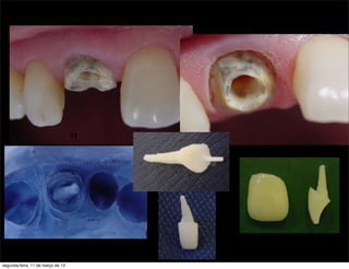 11
segunda-feira, 11 de março de 13
 